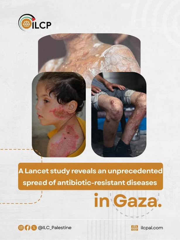 Spread of antibiotic-resistant diseases